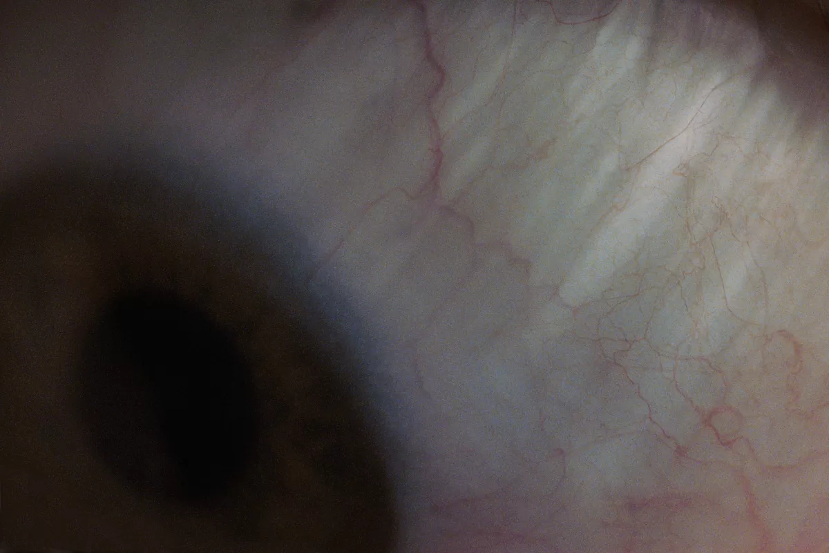 An eerie eye looking down by Photographer Fedor Vasilev